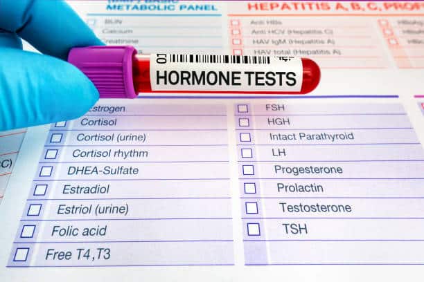 Hormones Testing in Slough