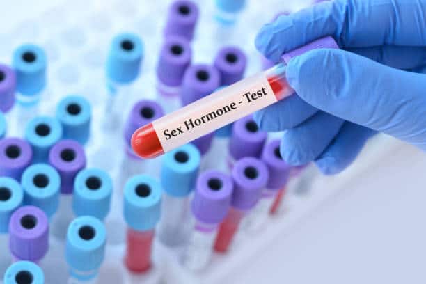 Sexual Hormones Test is Slough