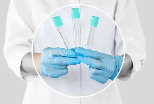 Slough uk Private Blood Test Clinic