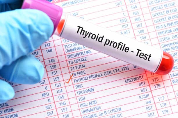 Thyroid in Slough Berkshire